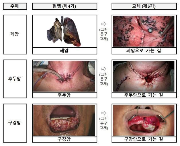 '폐암으로 가는 길' 담뱃갑 경고 더 세진다…23일부터 새 그림 적용