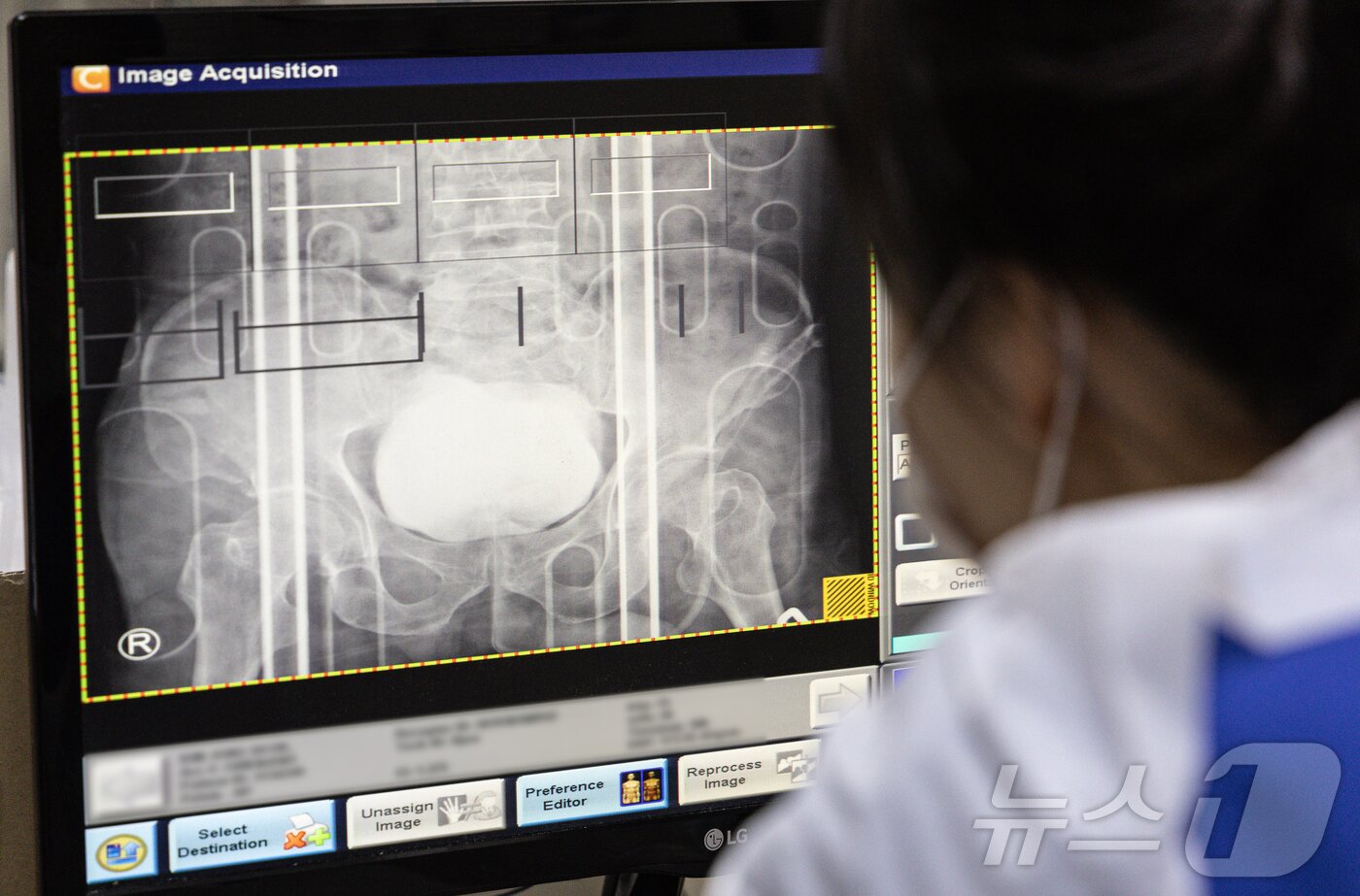 본문 이미지 - 의료진이 소생실에서 촬영한 검사 결과를 분석하고 있다. ⓒ News1 이재명 기자