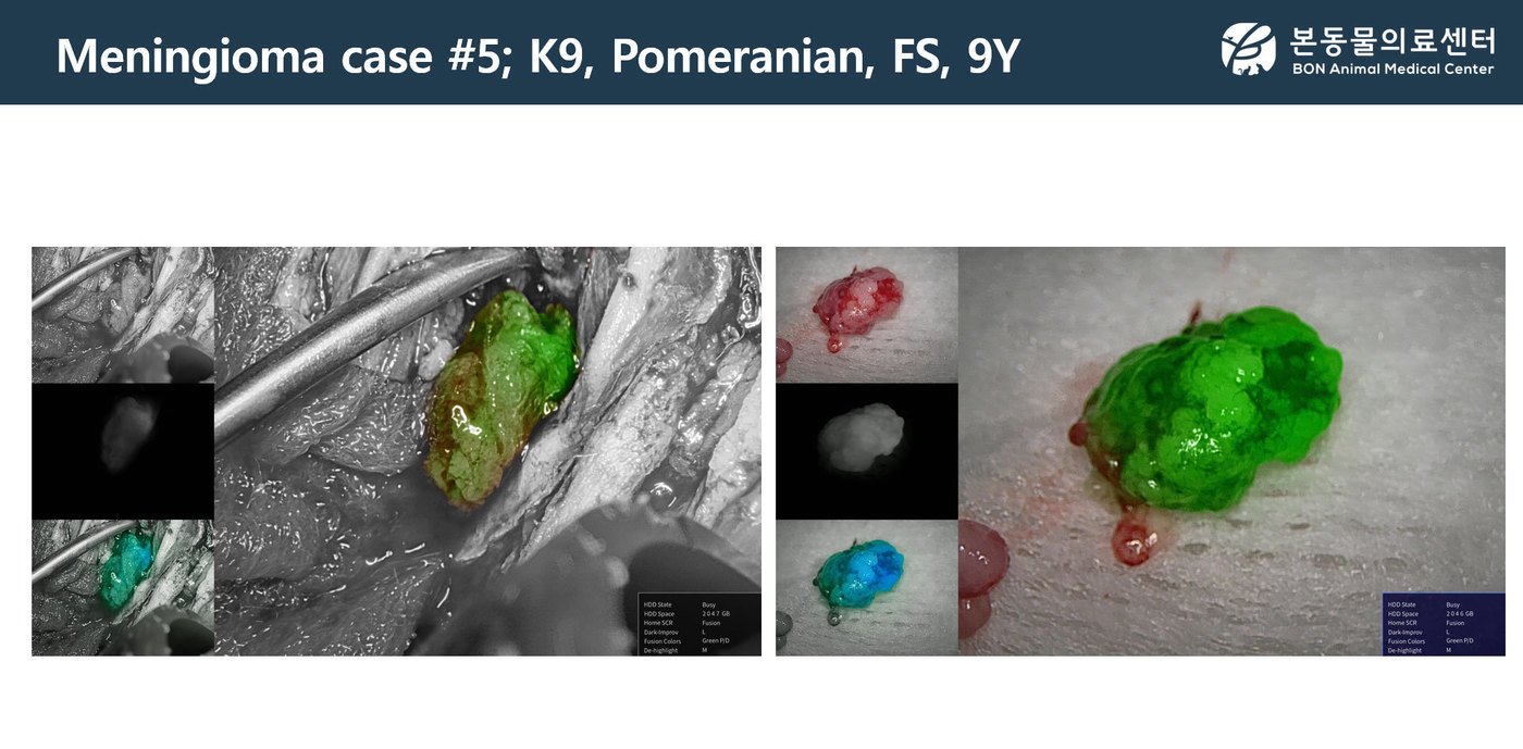 뇌수막종에서 형광 염색제인 인도시아닌 그린을 투여한 후 형광 내시경을 활용해 종양을 절제한 사례 &#40;동물병원 제공&#41; ⓒ 뉴스1