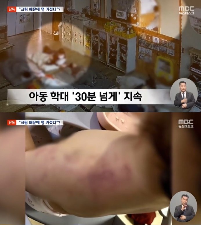 본문 이미지 - (MBC 갈무리)