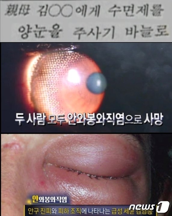  엄인숙은 수면제가 든 주사기로 친어머니 눈을 찔러 실명시키는 가 하면 두명의 남편도 눈을 찔러 실명에 이르게 한 후 그 후유증 등으로 결국 숨지케 했다. &#40;SBS 갈무리&#41; ⓒ 뉴스1 