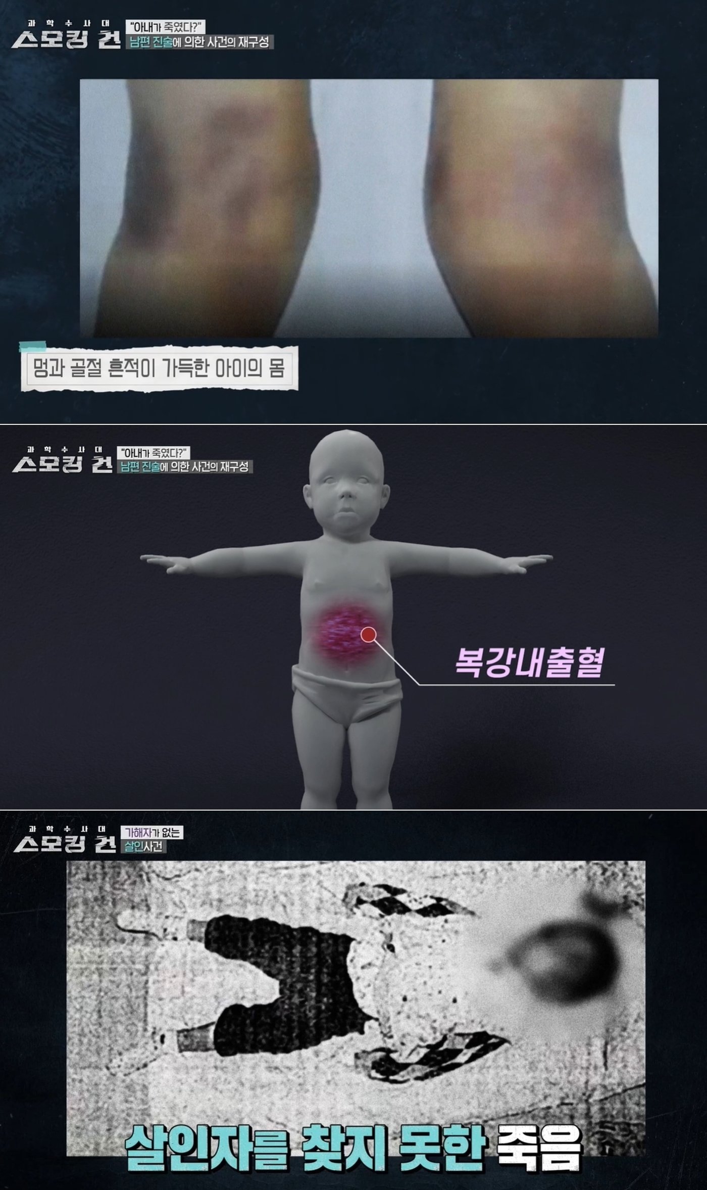 본문 이미지 - 풀리지 않은 미스터리 살인으로 종결된 '신림동 쌍둥이 동생 사망 사건'. / KBS2 스모킹건 갈무리