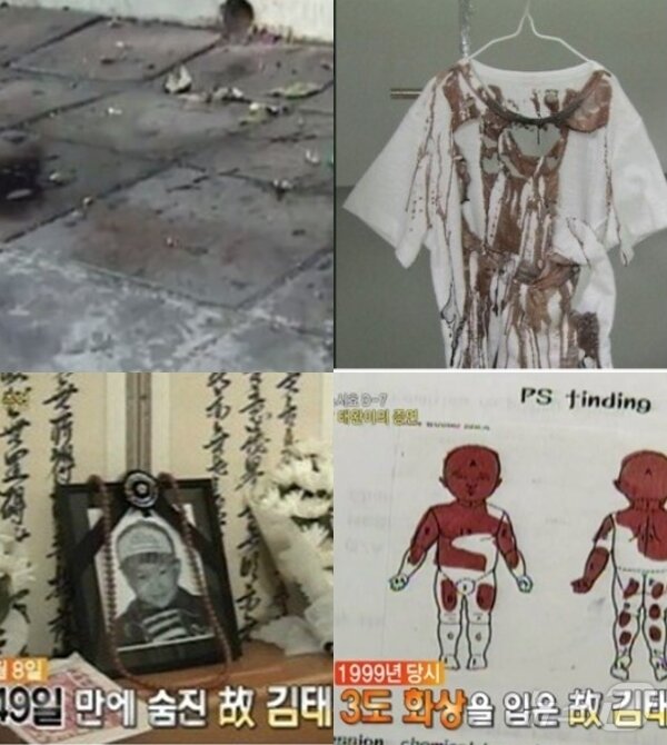 본문 이미지 -  1999년 5월 20일 대구시 동구 효목동의 김태완 군 황산테러 사건 현장(사진 왼쪽위에서 시계방향), 황선태러로 구멍이 나고 피 범벅이 된 태완이 옷, 전신 40% 3도 화상부위, 투병 49일만인 7월 8일 세상을 떠난 태완군. (MBC 갈무리)  