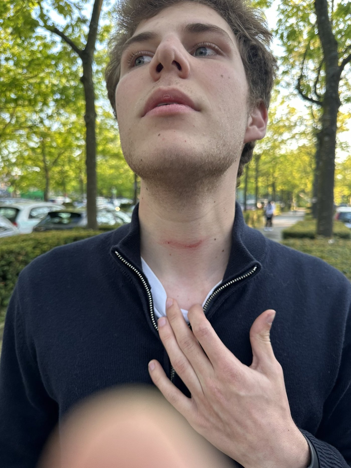 본문 이미지 - 가드 데사예스 벨기에 유대인학생 연합 회장이 벨기에 브뤼셀의 자유대학교에서 시위대에 공격을 당했다며 공개한 사진. <출처=엑스(X·구 트위터) 갈무리>