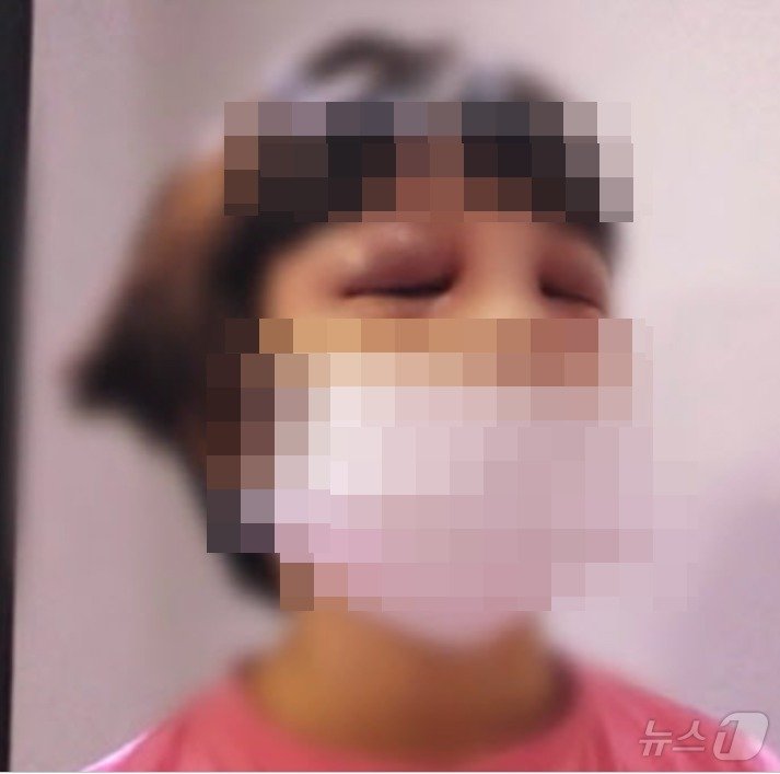 본문 이미지 - 이모 부부로 부터 맞아 눈두덩이가 시커멓게 멍든 딸 사진을 받은 친모는 항의는 커녕 '더 때려 달라'는 듯 복숭아 나뭇가지로 만든 회초리를 보냈다. (MBC 갈무리) ⓒ 뉴스1