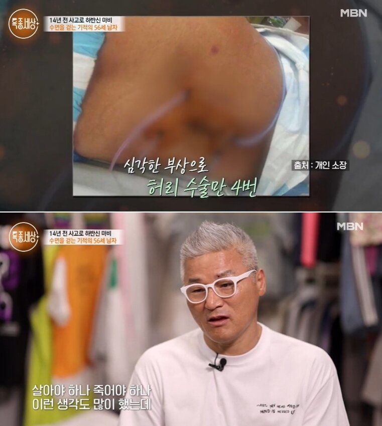 본문 이미지 - &#40;MBN &#39;특종세상&#39; 방송화면&#41;