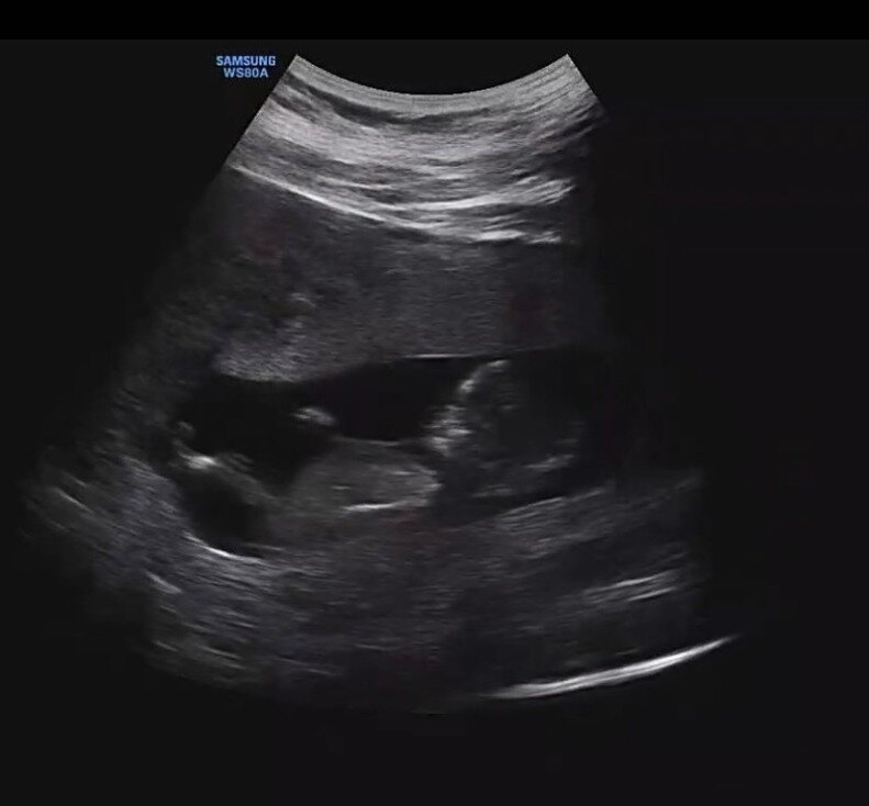 본문 이미지 - 나윤권 인스타그램