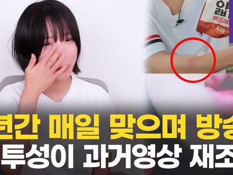 [영상] '천만 유튜버' 쯔양, 4년간 전 남친에 협박 당해…온몸 멍투성이
