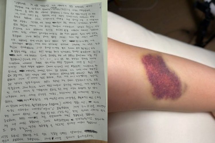 본문 이미지 - &#40;이 씨 엑스 갈무리&#41;