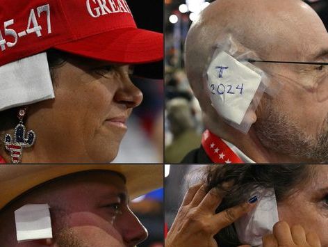 [포토] 오른쪽 귀에 붕대 감아 연대하는 트럼피들