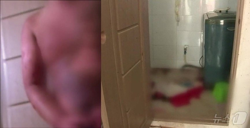 본문 이미지 - 공부에 집중하지 않는다면 끊임없이 폭행을 당한 과외제자는 온몸이 멍투성이었다. 오른쪽은 끓는 물에 전신 3도 화상을 입고 쓰러진 원룸 화장실. &#40;SBS 갈무리&#41;  ⓒ 뉴스1