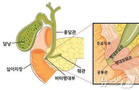 바터팽대부 부위&#40;센텀종합병원 제공&#41;