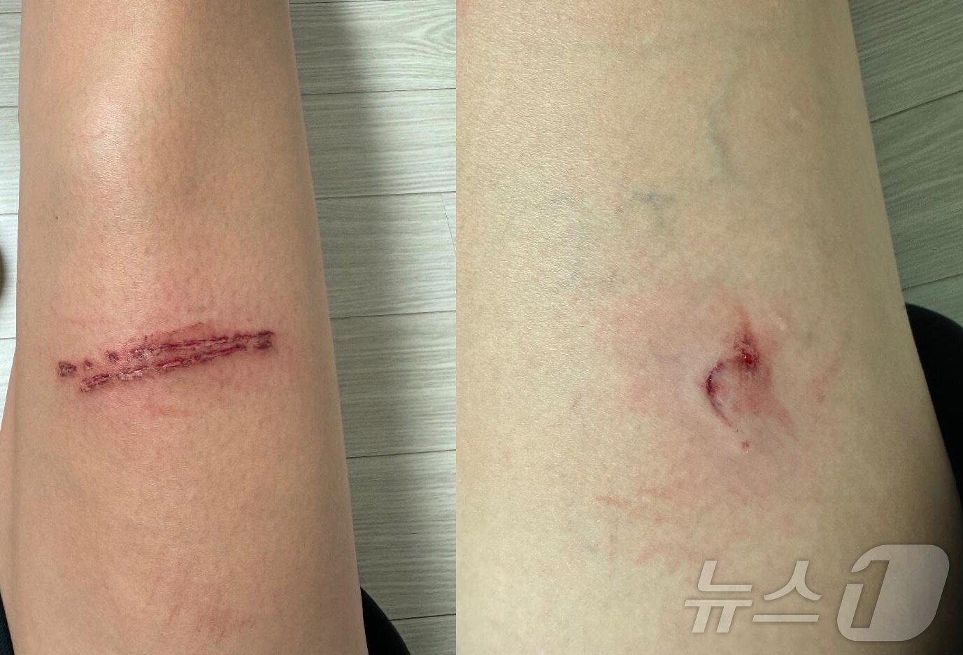 본문 이미지 - (보배드림 갈무리)