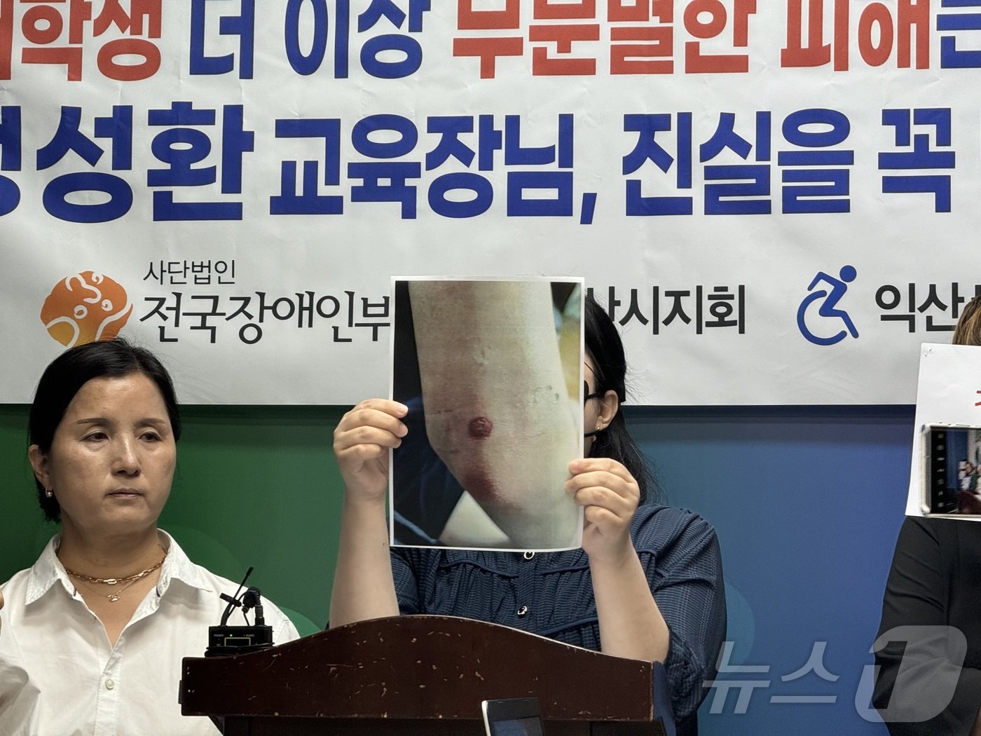 본문 이미지 - 피해 주장 학생 학부모가 A 학생의 상처 사진을 들고 설명하는 모습. 2024.8.5/뉴스1 장수인 기자