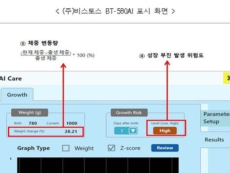 식약처, '극소저체중' 출생아 위험관리 소프트웨어 허가