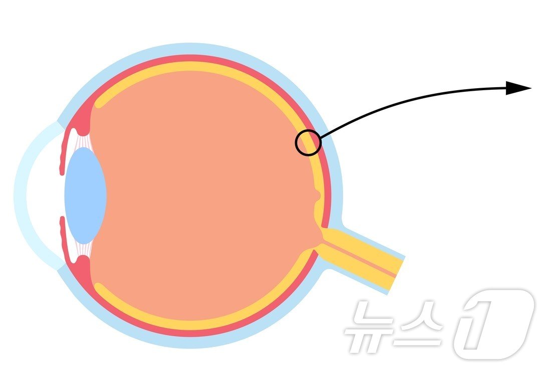 본문 이미지 - 망막(화살표 친 부분) / 뉴스1 ⓒ News1