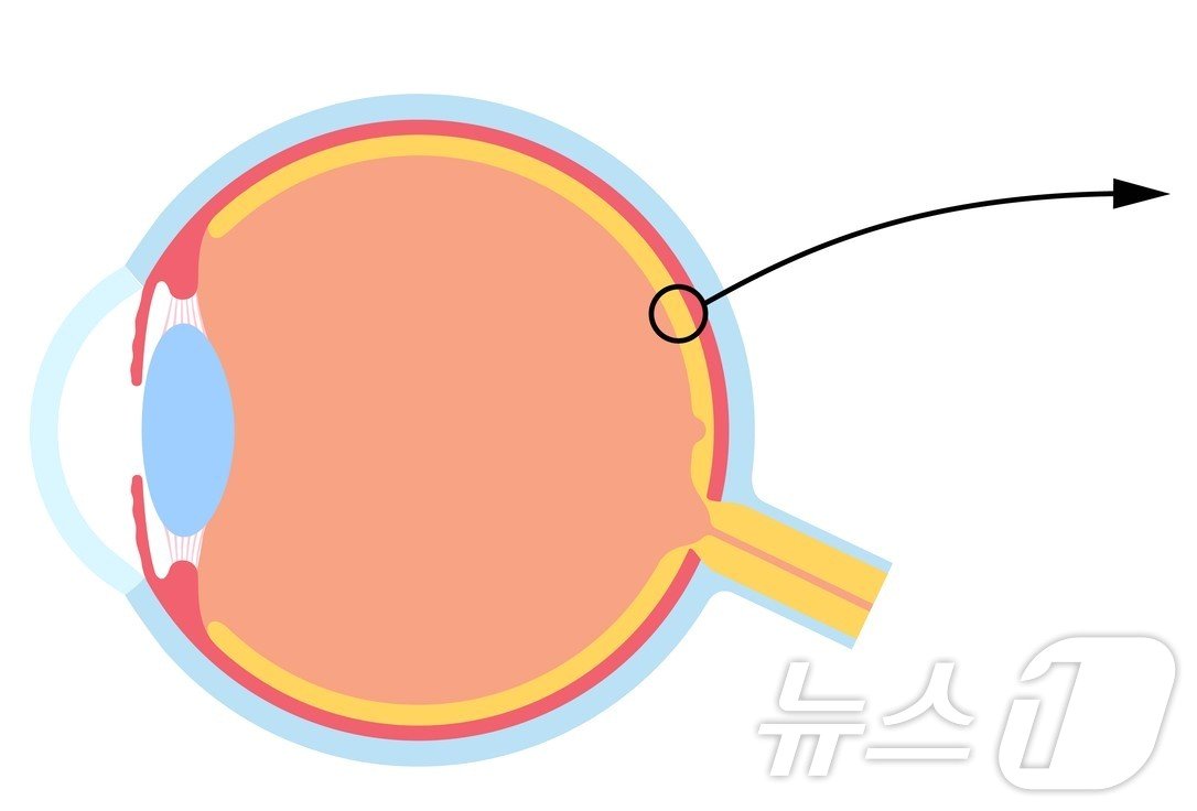 망막&#40;화살표 친 부분&#41; / 뉴스1 ⓒ News1