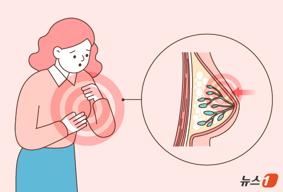 유방암 환자, 임신으로 약 끊어도 안심…"재발·사망 위험 차이 없어"