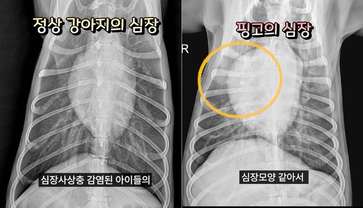 본문 이미지 - 정상 강아지의 심장 형태와 심장사상충에 감염된 핑고의 심장 형태&#40;병원 제공&#41; ⓒ 뉴스1
