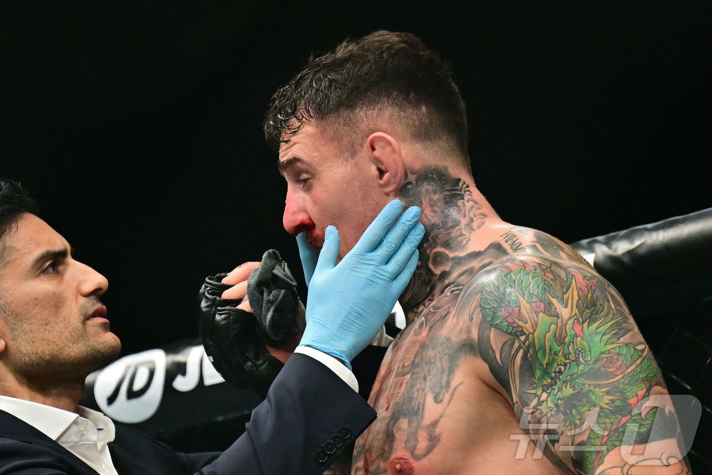 본문 이미지 - 눈을 찔린 뒤 의료진의 체크를 받는 아스피날.ⓒ AFP=뉴스1