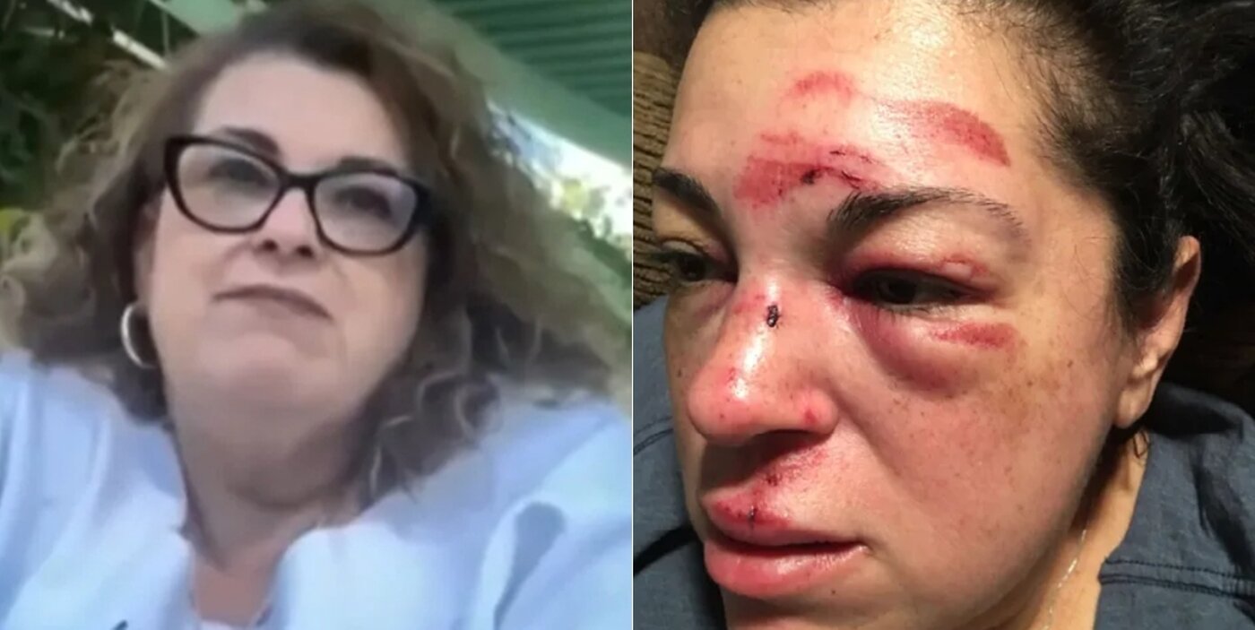 본문 이미지 - 넘어짐 사고를 당한 저스틴 구롤라. 사고 전후 사진 NBC