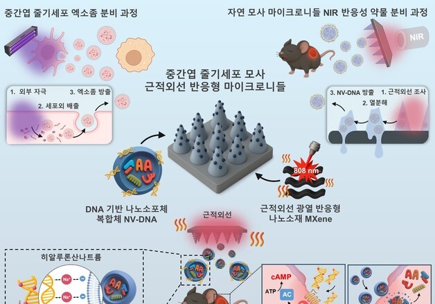 당뇨성 창상 치료 더 수월하게…근적외선 약물 플랫폼 개발