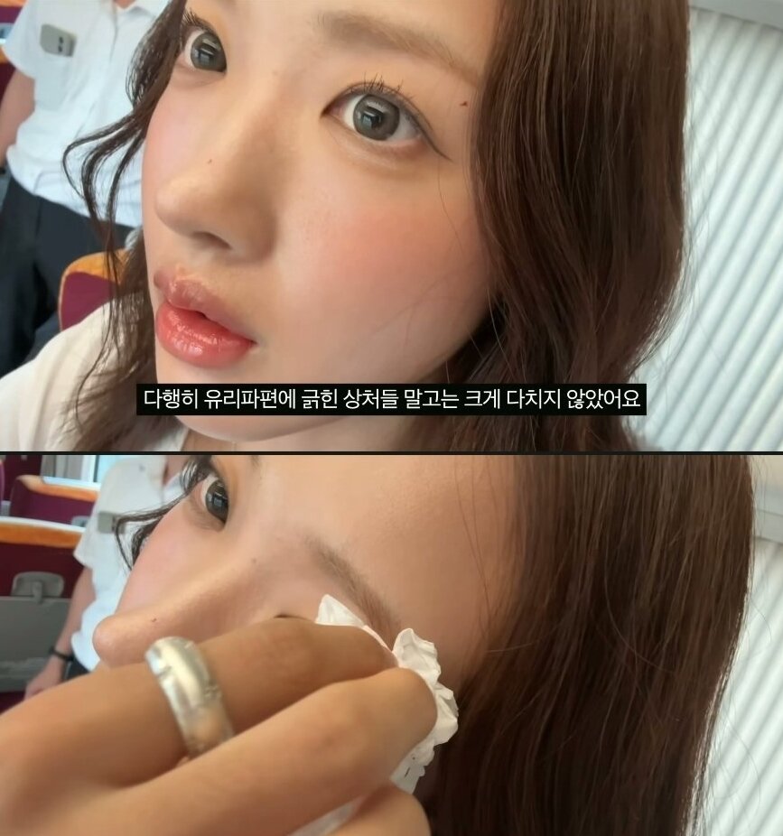 본문 이미지 - 일본여행중 열차사고를 당한 20대 여성 피해자. 출처=유튜브 &#39;데일리 조이&#39;