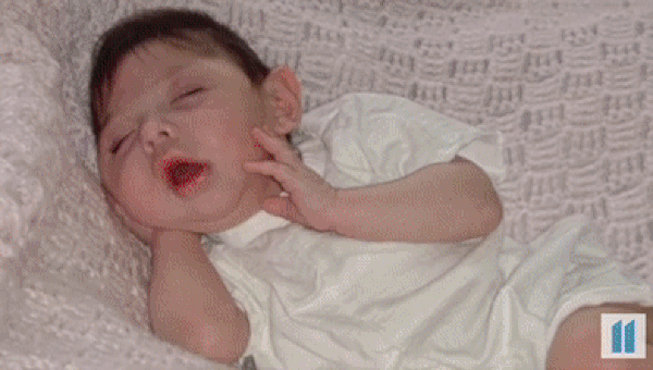 "네살 못 넘겨" 뇌 없이 태어난 딸…20세 생일 맞았다