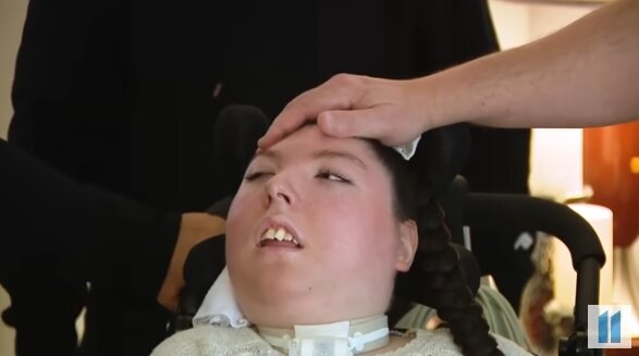 본문 이미지 - 희귀 질환인 '수뇌증'을 앓고 있는 미국의 20세 여성의 사연이 화제가 되고 있다. 출처=피플