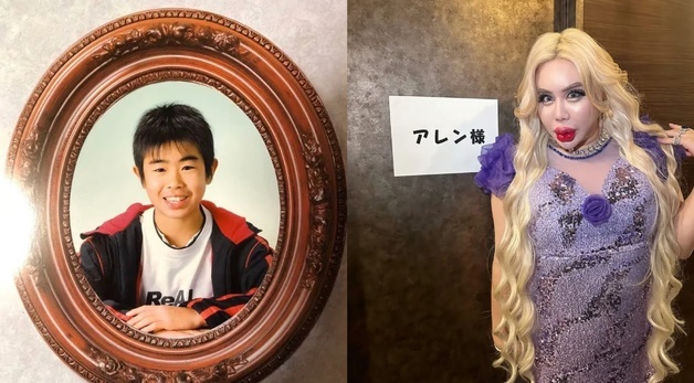 왕따였던 남성, 10억 들여 200회 성형…33만 日 인플루언서 됐다