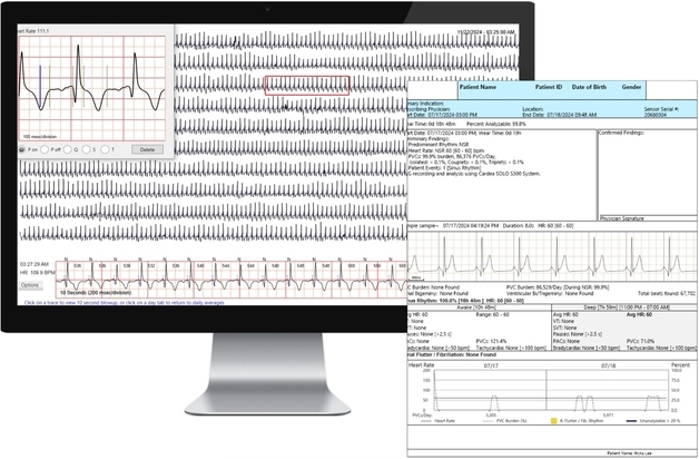 드림텍, 부정맥 진단 플랫폼 日 시장 안착…누적 3만건 분석