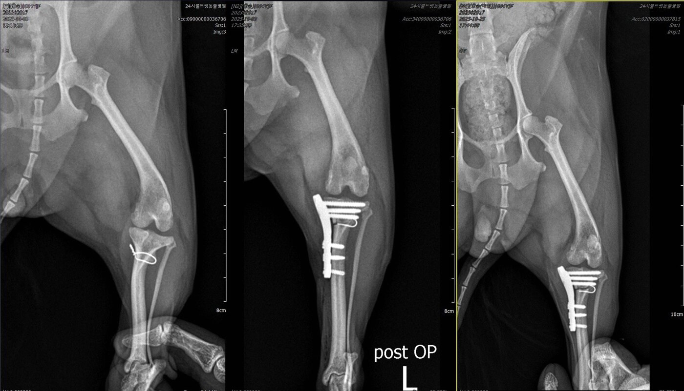 본문 이미지 - 콩순이의 TPLO 수술 전, 후, 최근 방사선 사진(월드펫동물메디컬센터 제공) ⓒ 뉴스1
