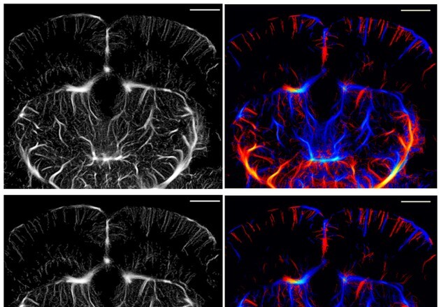 DGIST, 초음파로 뇌 속 미세혈관 보는 기술 업그레이드