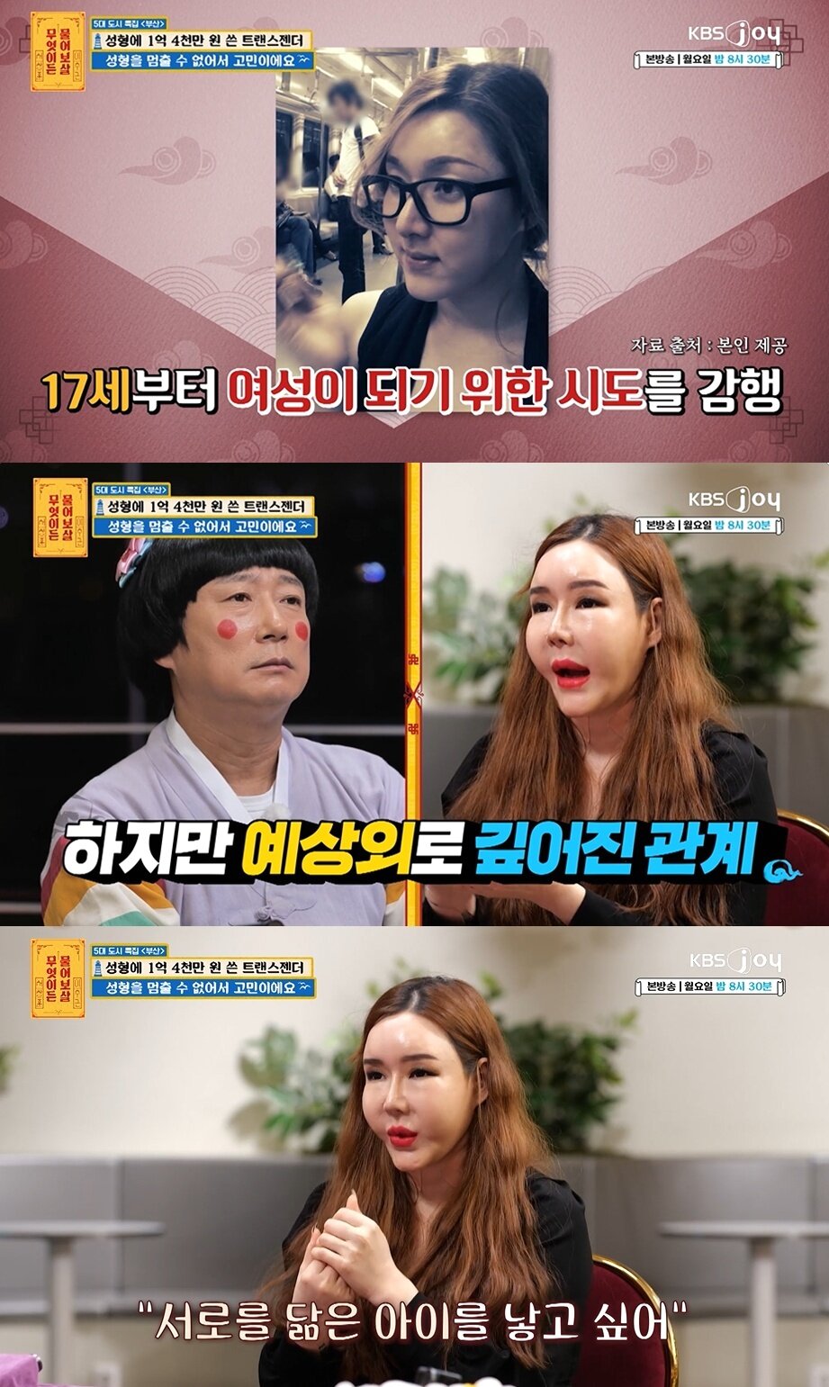 본문 이미지 - &#40;KBS joy &#39;무엇이든 물어보살&#39; 갈무리&#41;