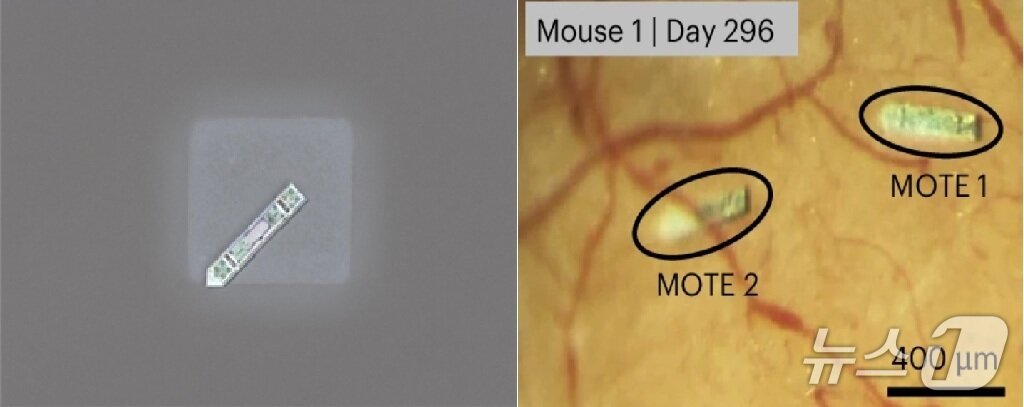 본문 이미지 - 소금 결정위에 있는 MOTE 뉴럴 임플란트&#40;왼쪽&#41;, 실험용 쥐에 이식된지 296일 지난 후의 MOTE 뉴럴 임플란트들&#40;오른쪽&#41;. &#40;KAIST 제공. 재판매 및 DB금지&#41; 2025.11.27/뉴스1