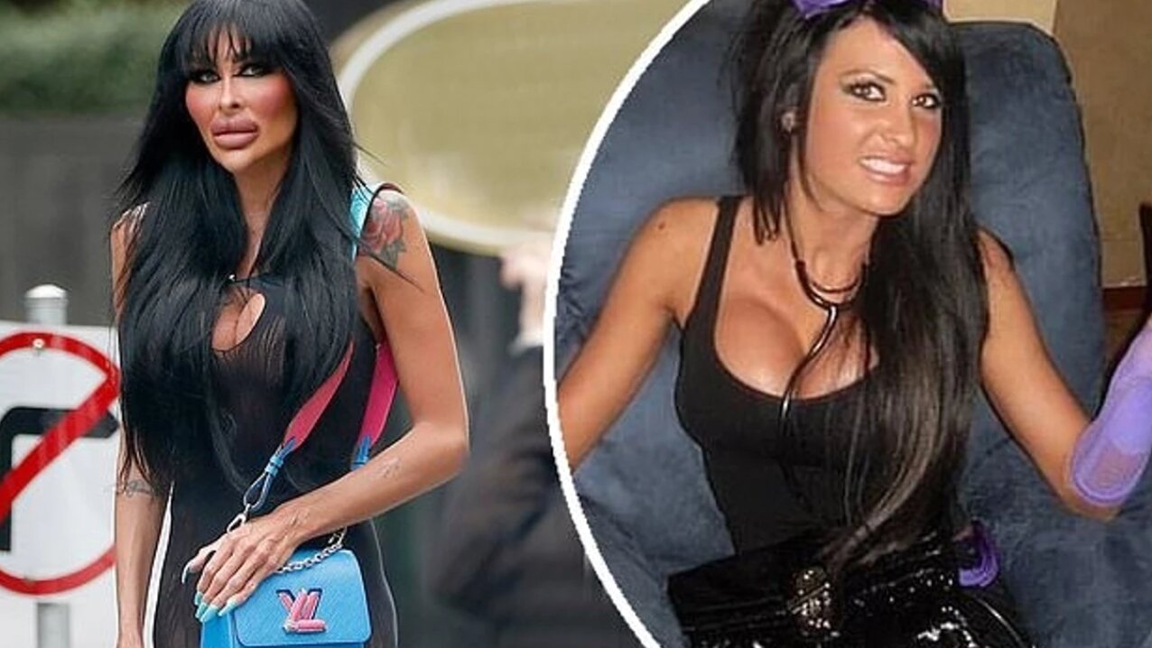 본문 이미지 - 호주 출신 여성 타라 제인 맥코나키 수술 전과 후 사진. 출처=더선