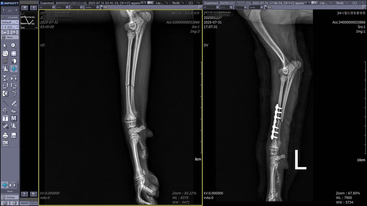 본문 이미지 - 골절 수술 전 후 방사선 사진(동물병원 제공) ⓒ 뉴스1
