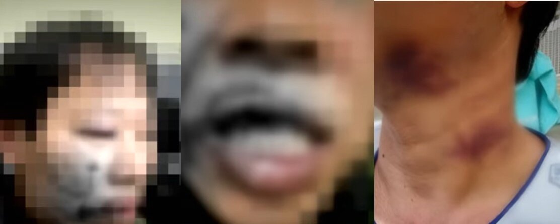 본문 이미지 - &#40;JTBC &#39;사건반장&#39; 갈무리&#41;