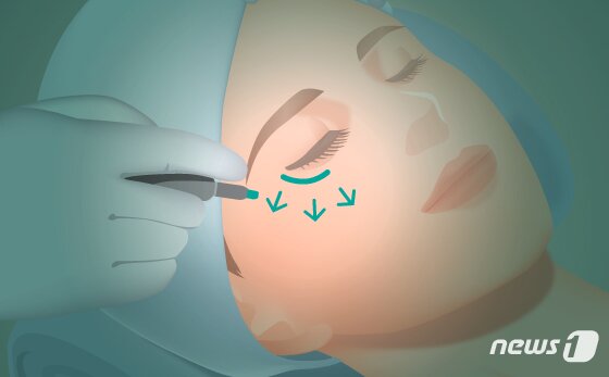 본문 이미지 -  ⓒ News1 DB