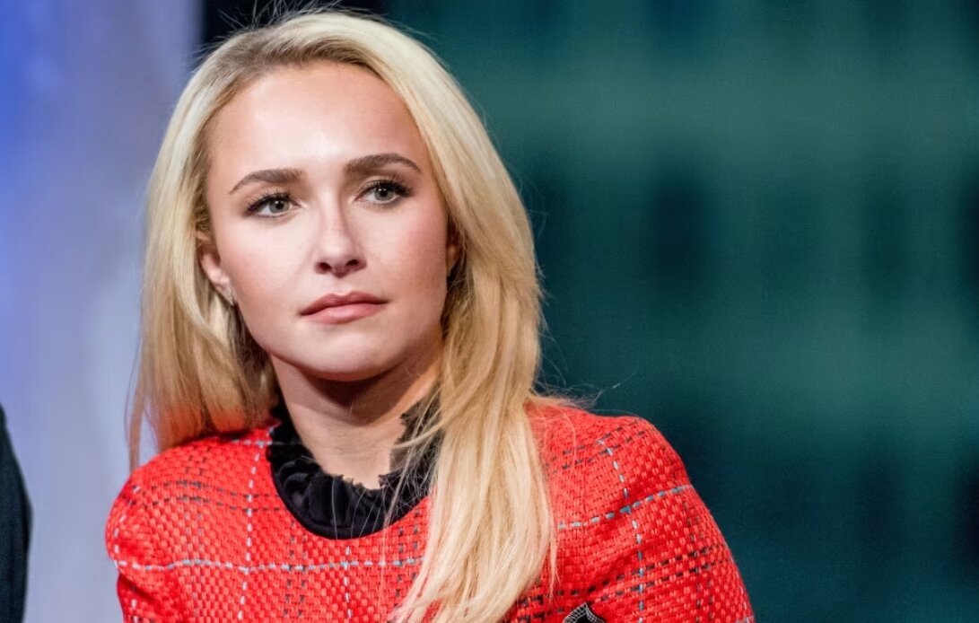 본문 이미지 - 할리우드 배우 헤이든 파네티어가 알콜중독으로 인해 심각한 탈모를 겪었다고 고백했다. 출처=CNN