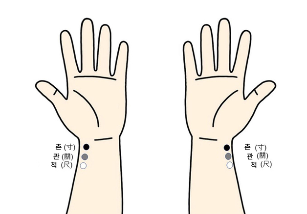 오른쪽 어깨 아픈데 왼팔에 침을?…"'거자침법' 효과 검증"