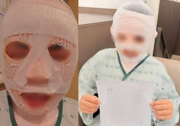 잠든 여친 얼굴에 끓는 물 부은 한국 남성…"딴 남자 못 만나게 하려고"