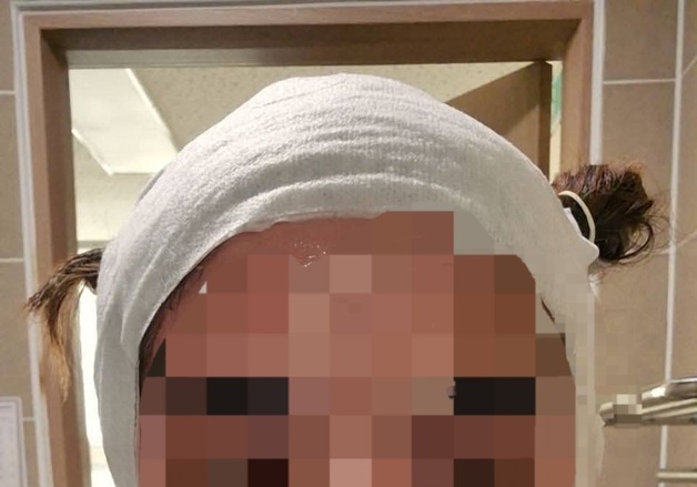 "떠날까 봐"…잠든 태국인 아내 얼굴에 뜨거운 물 부은 40대 남성