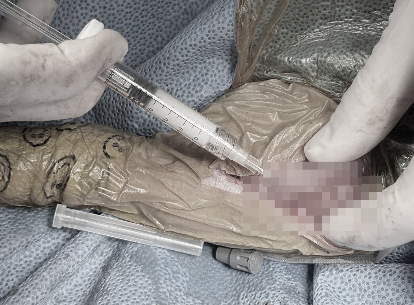 본문 이미지 - 권일 원장이 TPLO 수술을 진행하며 콜라겐 관절주사 애니씰C를 시술하고 있다&#40;N동물의료센터 강북점 제공&#41;. ⓒ 뉴스1