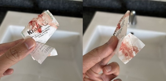 "지하철서 모르는 사람이 팔에 피 묻히고 도망"…병 옮기려 했나?