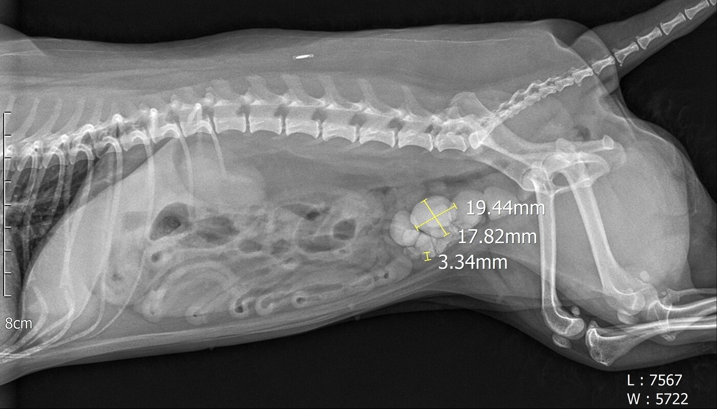본문 이미지 - 방사선 검사로 확인된 방광결석들&#40;병원 제공&#41; ⓒ 뉴스1