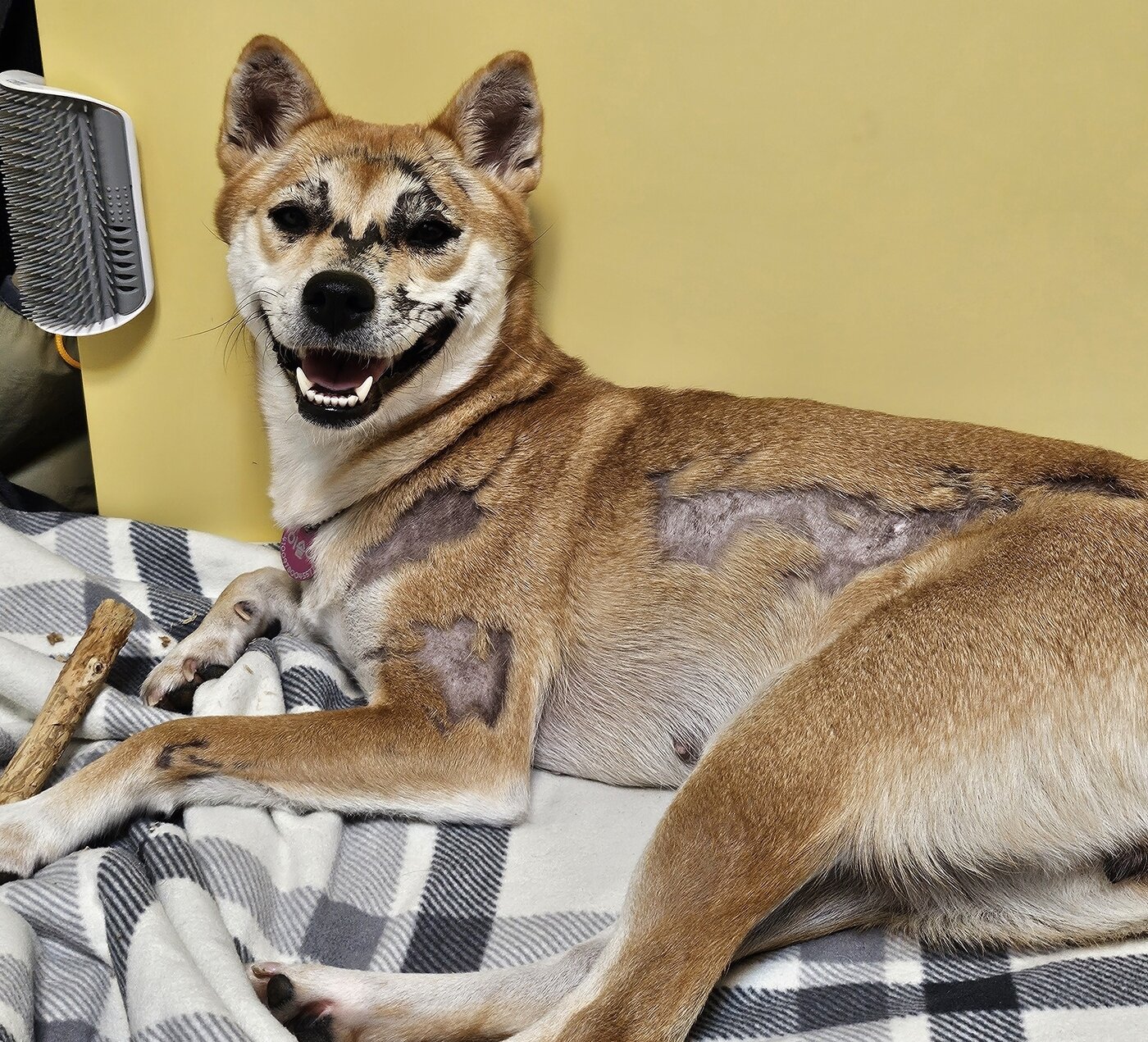 본문 이미지 - 보호자는 범범이의 화상 흉터가 상처가 아니라 용기와 인내의 증표처럼 느껴진다고 전했다(인스타그램 2_sol_2_ 제공). ⓒ 뉴스1