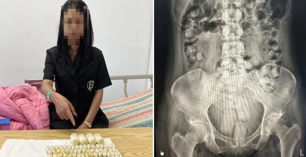 '콘돔으로 감싸 '거기' 삽입'…4억원대 마약 밀반입 시도한 여성 2인조