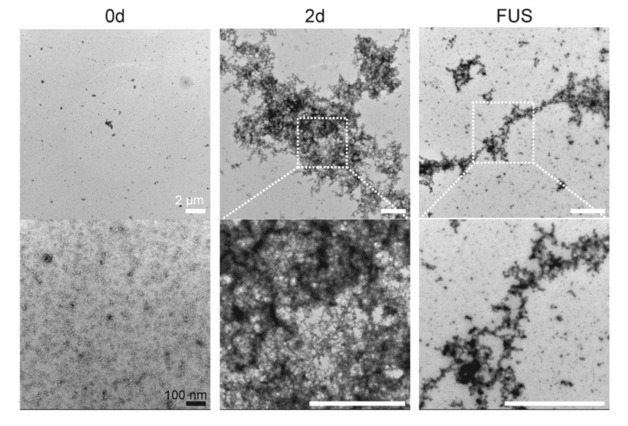 초음파로 치매 치료 길 열었다…한림대동탄성심병원 교수진 연구