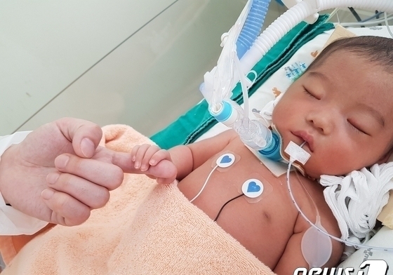 생후 5일만에 학대로 의식 잃은 '아영이'…신생아실은 '지옥'이었다